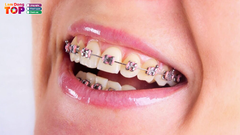 Top-10-dia-chi-nieng-rang-lam-dong-uy-tin-hang-dau